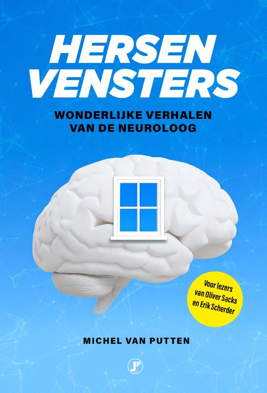 Hersenvensters